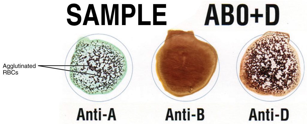 Blood groups