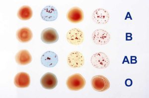 Blood group test